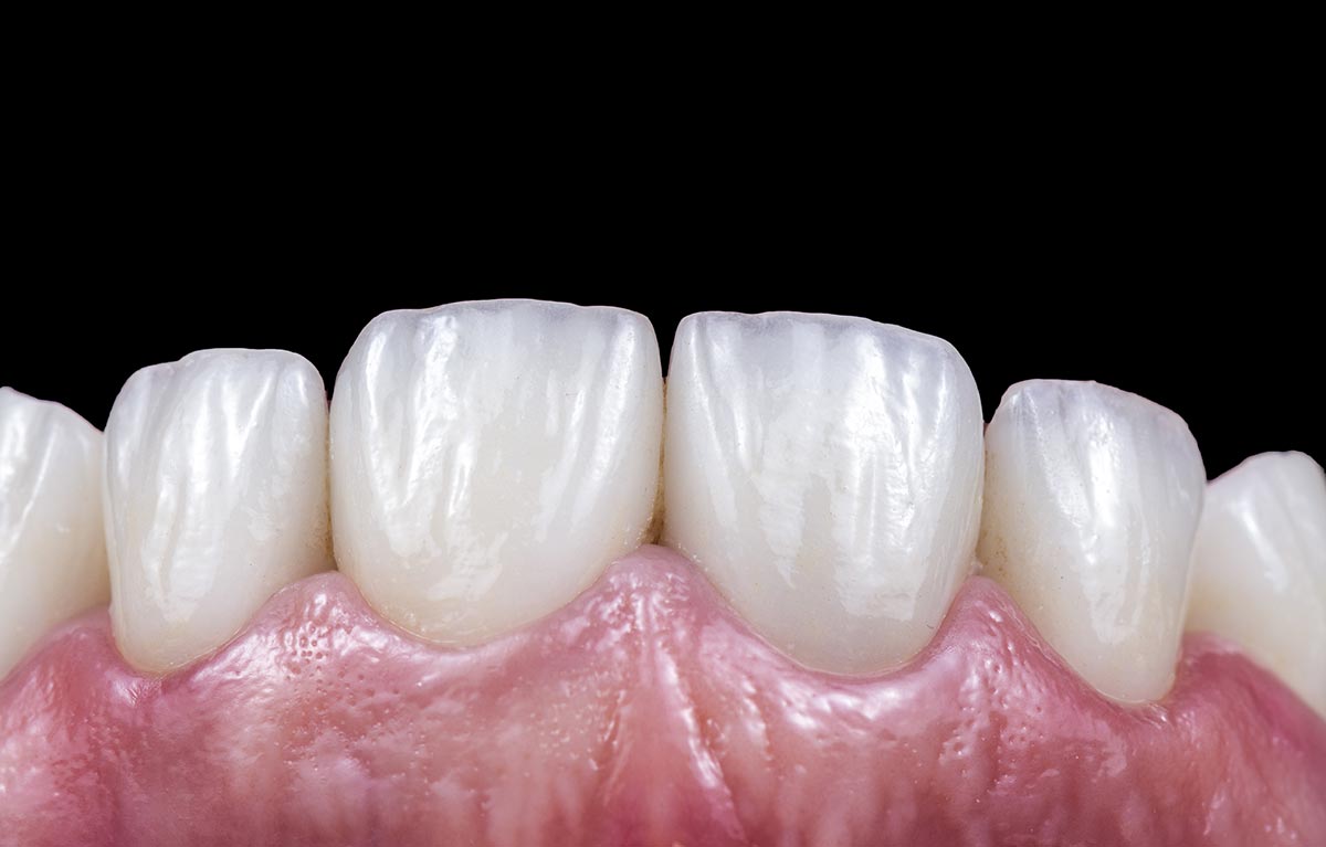 A close-up image of a person's teeth. The teeth are white and healthy-looking. The gums are pink and healthy-looking.