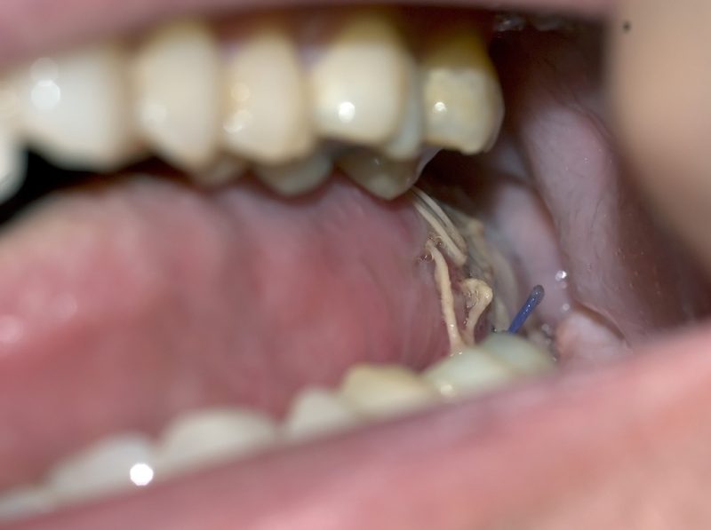 adsterra dan adsense aesthetic dental surgery