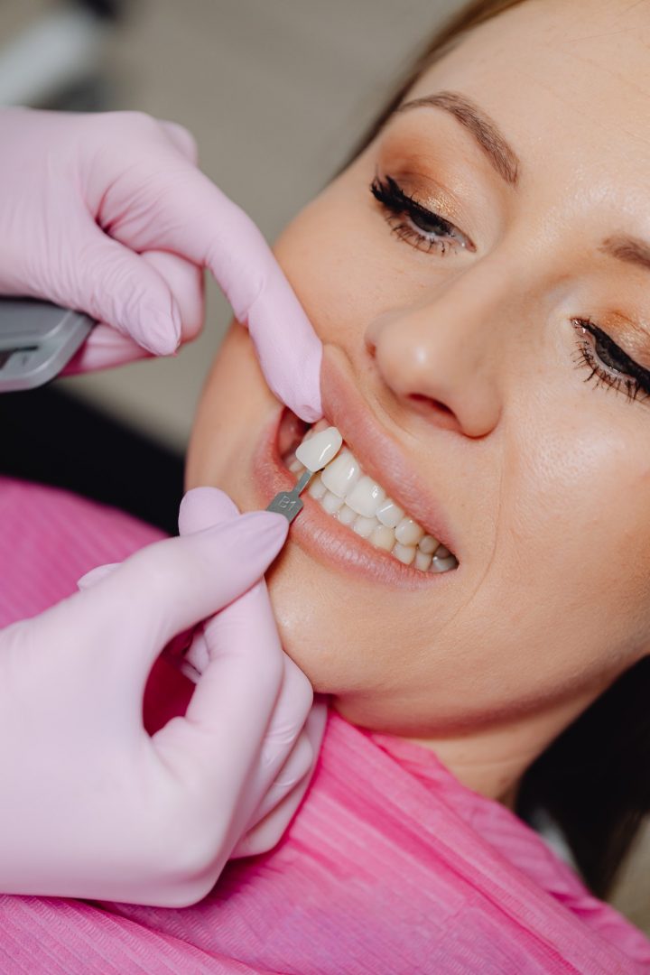 A woman getting a dental veneer put on.